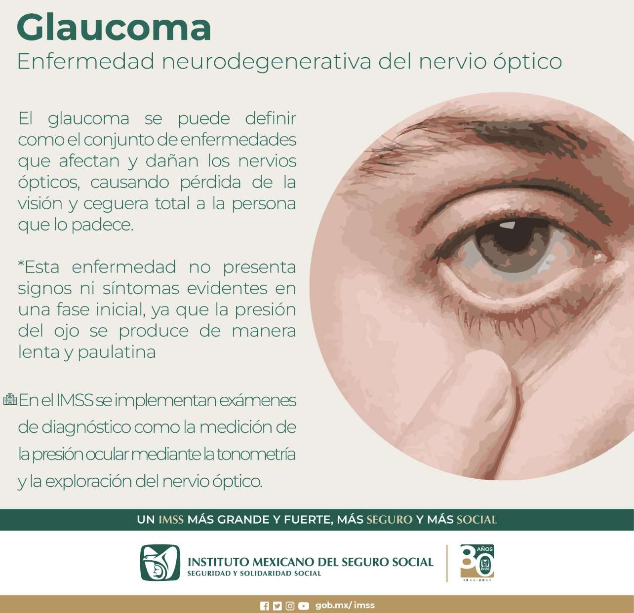 Invita IMSS Hidalgo a prevenir el glaucoma 