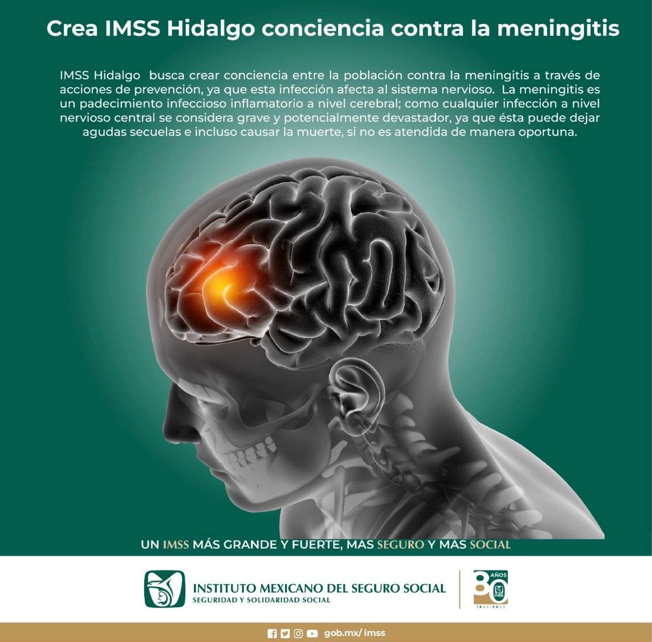 Concientiza IMSS Hidalgo sobre la meningitis