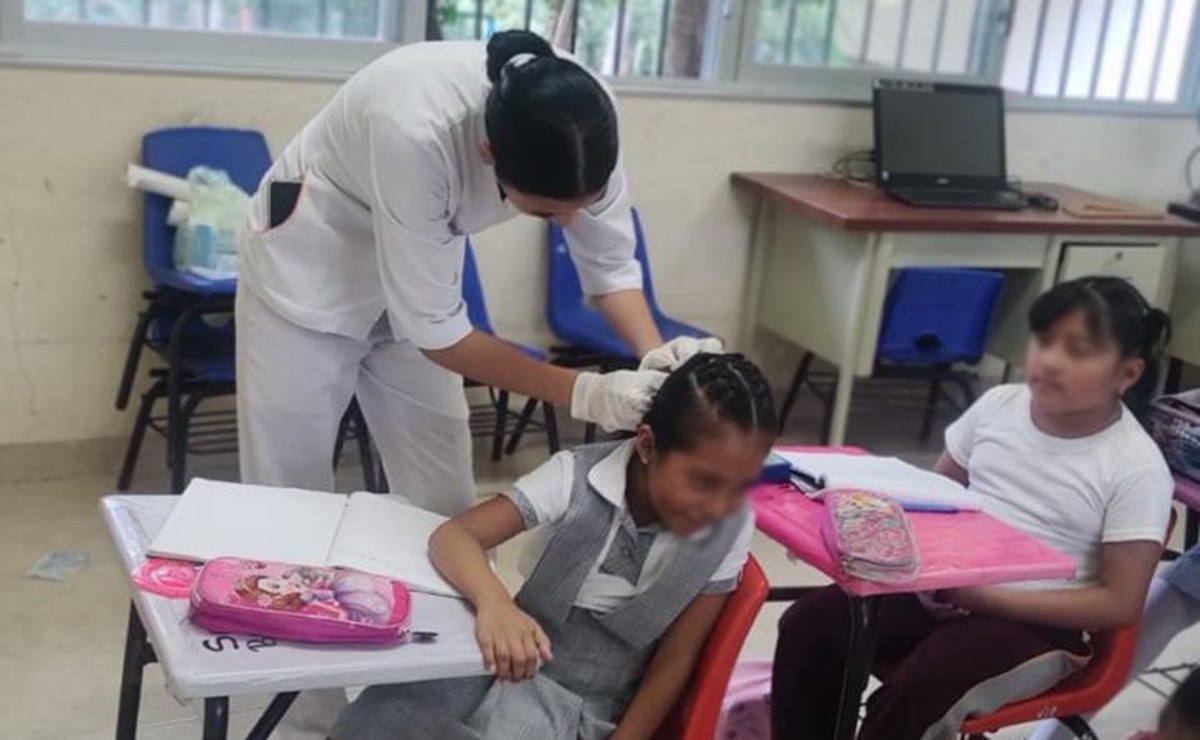 Recomienda IMSS-Bienestar acudir al médico ante la sospecha de pediculosis
