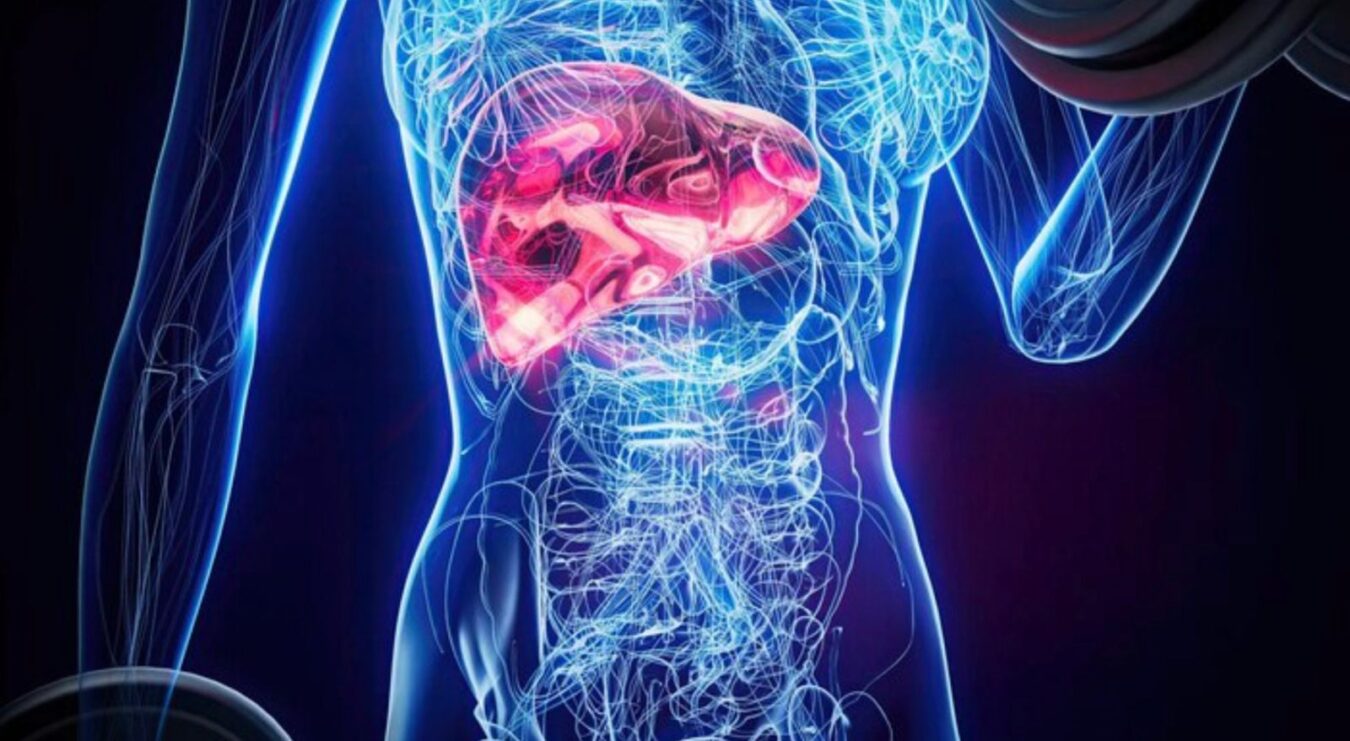 IMSS advierte que el hígado graso puede derivar en cirrosis o cáncer