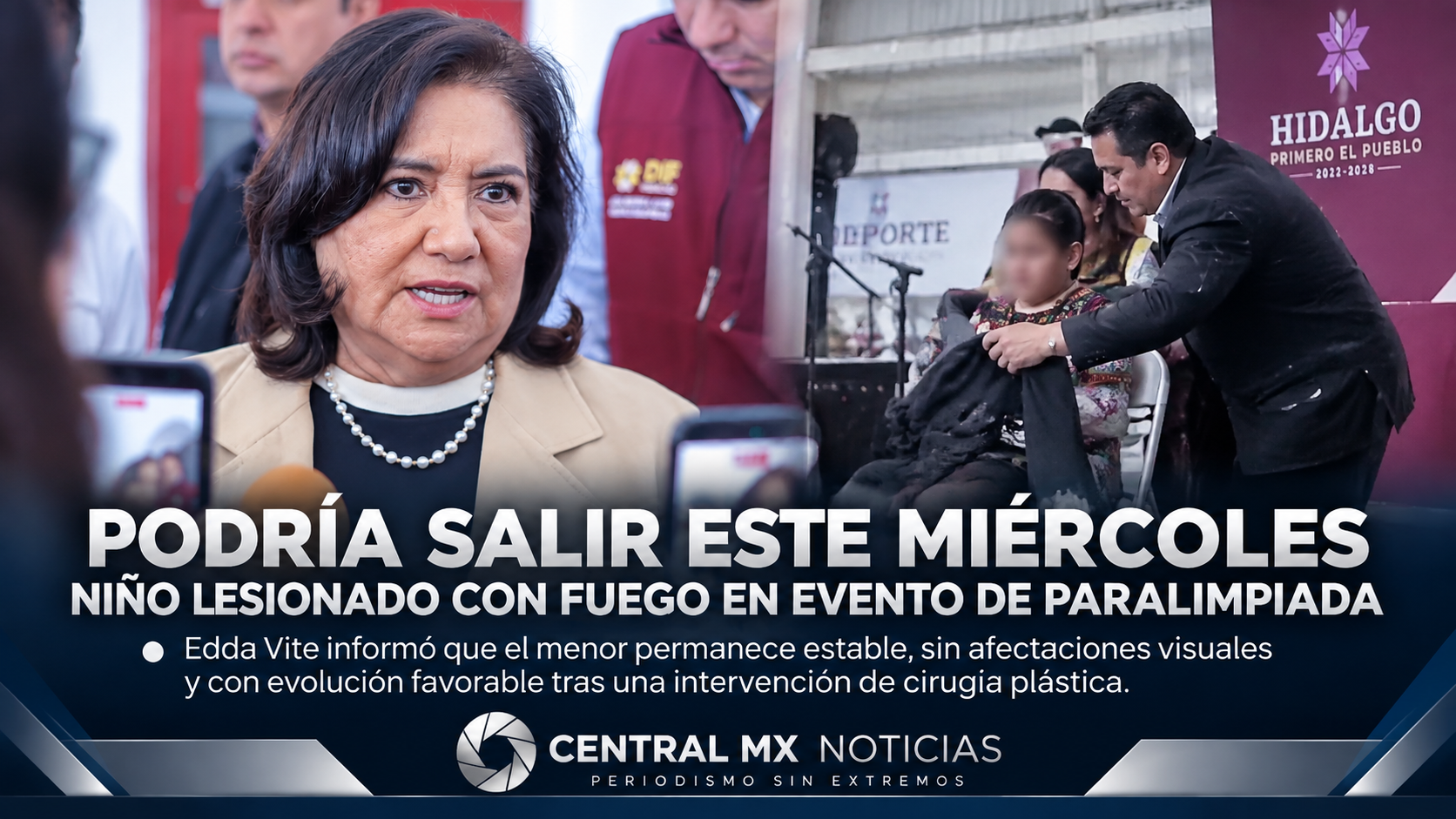 Podría salir este miércoles niño lesionado con fuego en evento de Paralimpiada